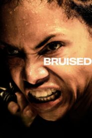 Bruised – Herida